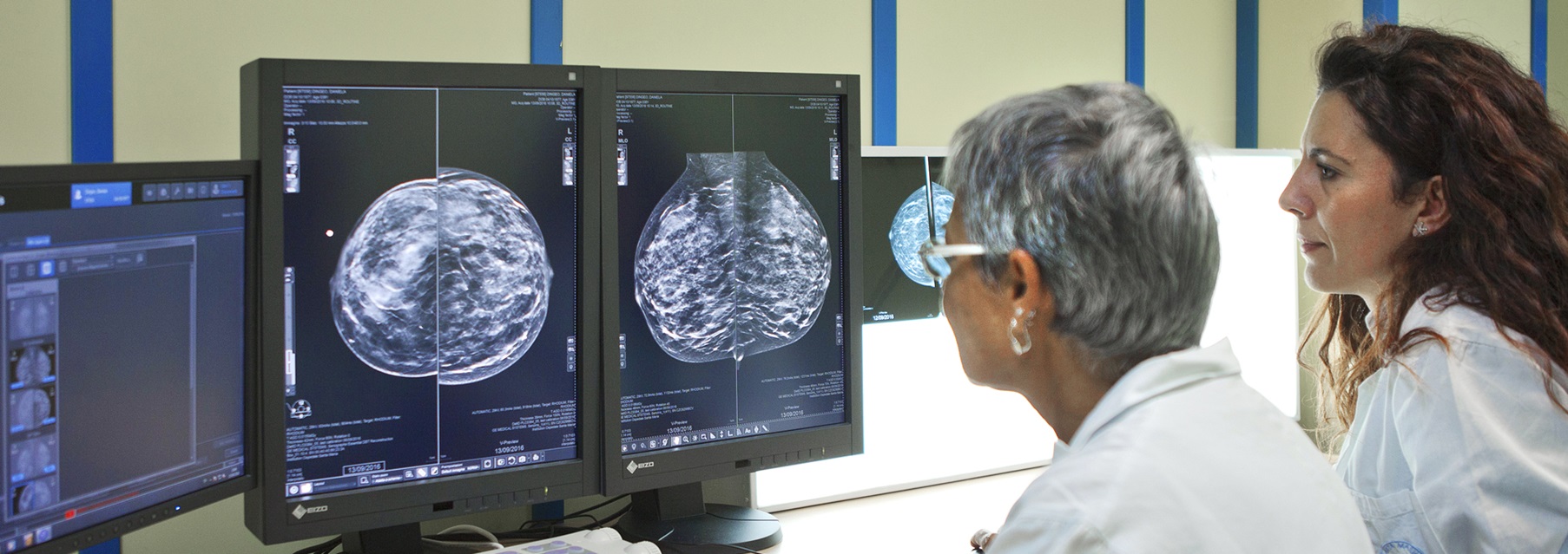 СИСТЕМА ТОМОГРАФИИ МОЛОЧНОЙ ЖЕЛЕЗЫ